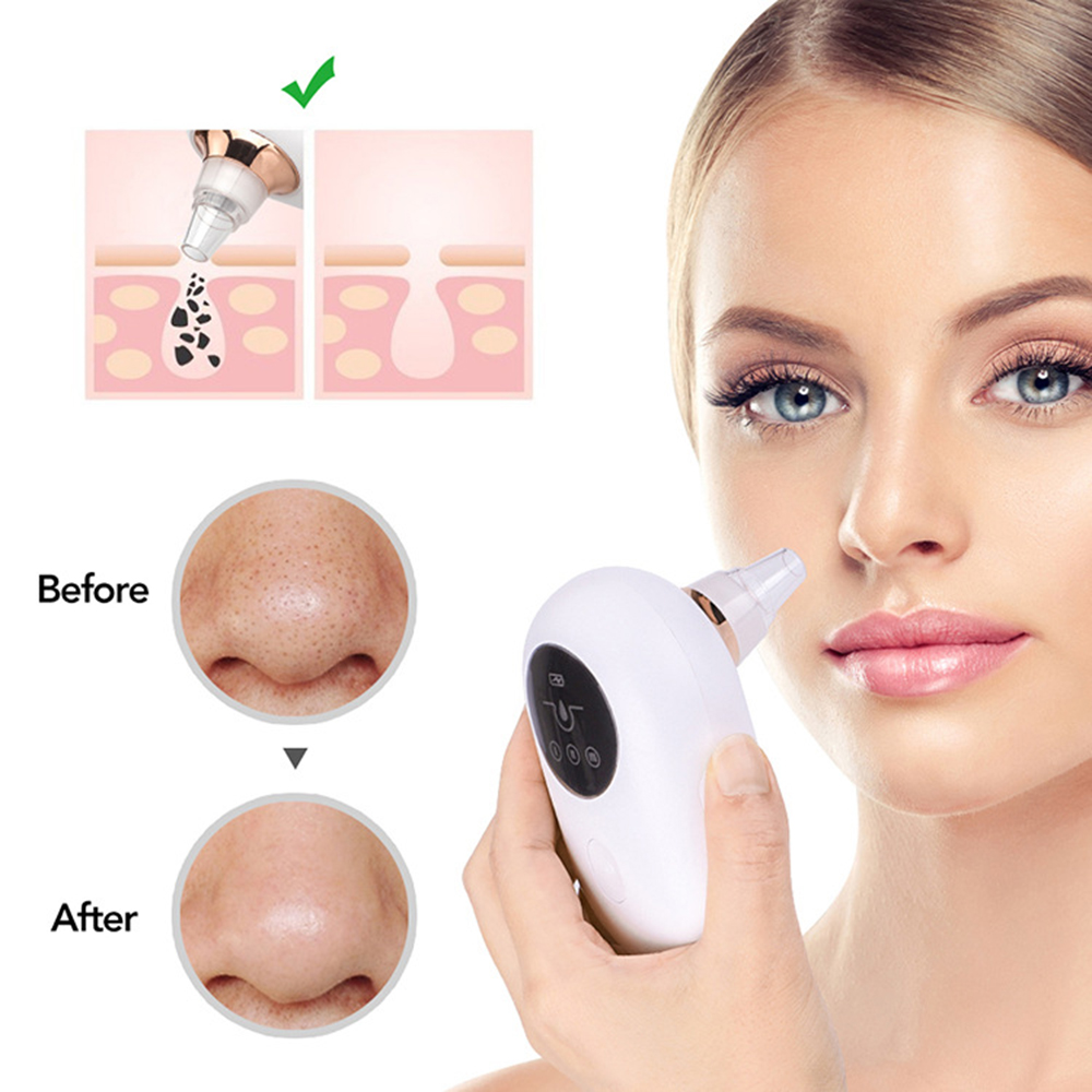 Electric Blackhead Remover & Pore Vacuum