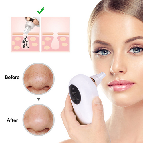 Electric Blackhead Remover & Pore Vacuum